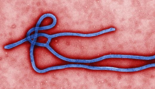 警惕最新病毒病人，你需要了解這些關(guān)鍵信息！