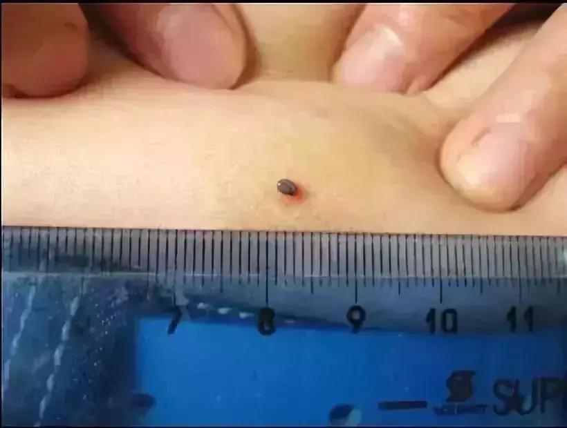 小明快樂疫情日志，最新疫情發(fā)布與日常觀察