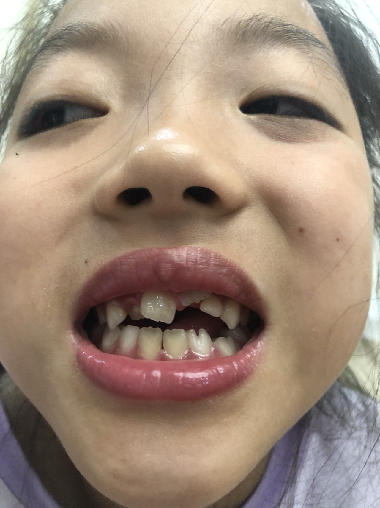 莊最新牙齒技術(shù)揭秘，牙齒美容新選擇