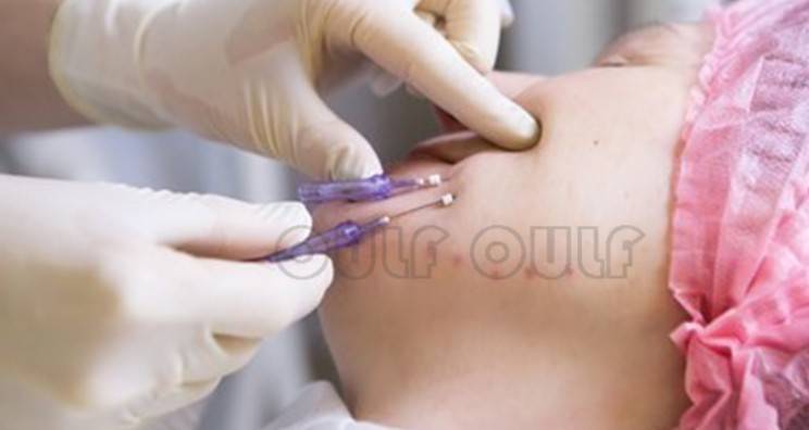 線雕最新手法，背景、發(fā)展、時(shí)代地位及展望